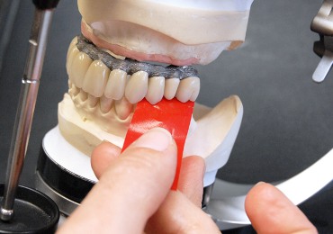 protesi dentali